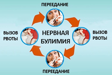 Лечение булимии в Шаховской